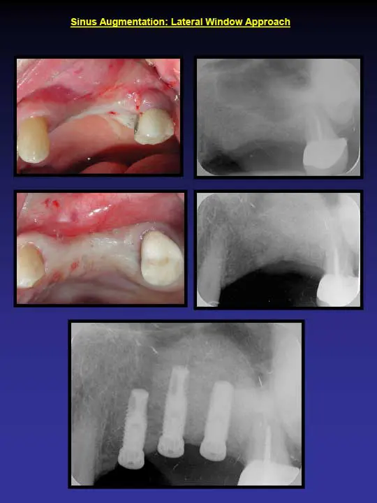 before dental work