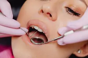 Photo by Karolina Grabowska: https://www.pexels.com/photo/close-up-photo-of-a-woman-getting-a-dental-check-up-6627536/